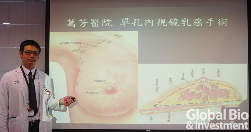 20160823-萬芳醫院一般外科主任張渭文醫師說明單孔乳癌內視鏡手術GBI