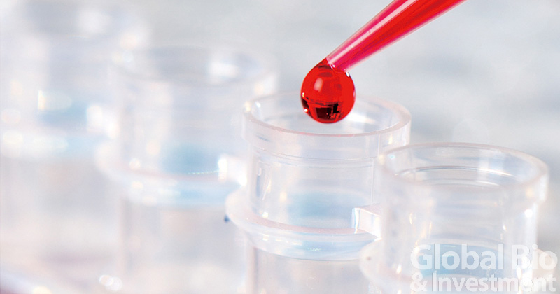 《Science》子刊: 利用片段大小特徵增強對ctDNA的檢測分析。