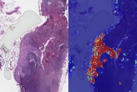 Google AI 再下一城 乳癌圖像辨識準確率達99%。(圖片來源:Gigazine)