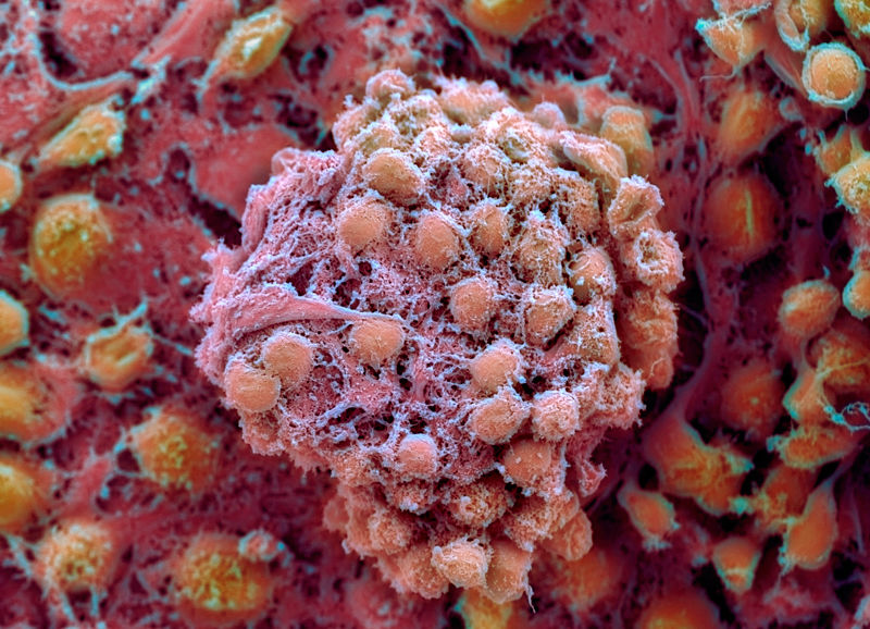 Human embryonic stem cells were coaxed into embryo-like structures to study the earliest stages of development. Credit: Prof. Miodrag Stojkovic/SPL
