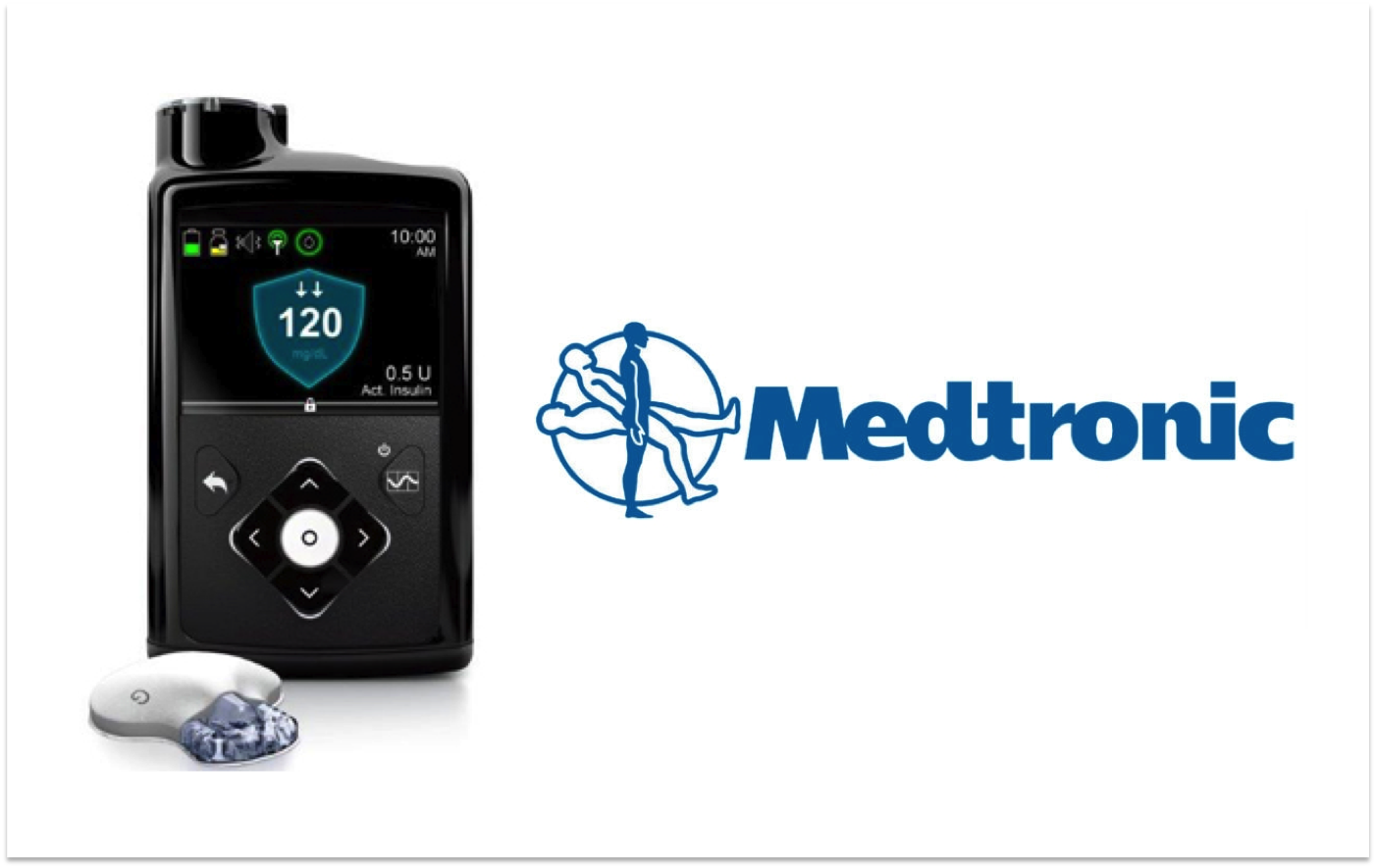 美敦力(Medtronic)的MiniMed 670G混合閉環系統也於近日獲得美國FDA核准,將使用範圍擴大至7至13歲的1型糖尿病患者。