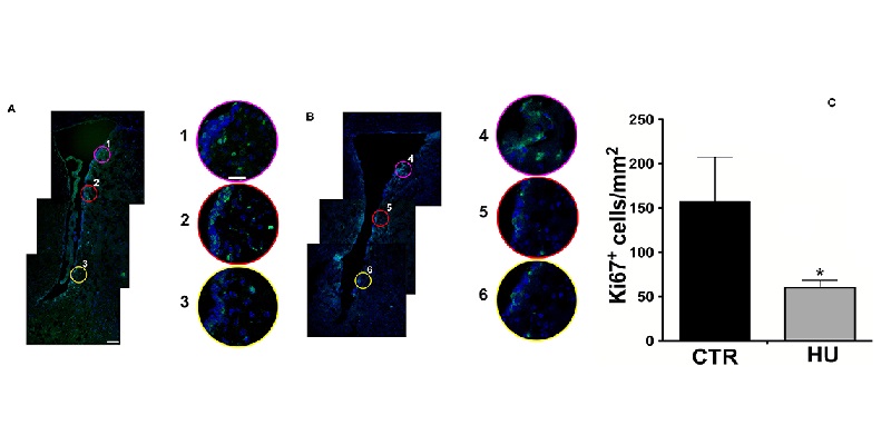 A:為對照組B:為HU組C:為ki67數據化 (Ki67表現綠螢光) 資料來源:Frontiers in Neuroscience