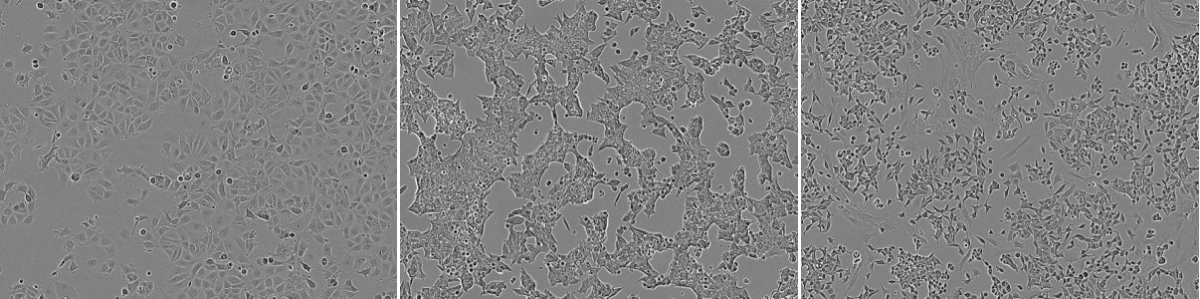 同為MCF7細胞株 卻具有不同細胞型態(圖片來源:《Nature》)