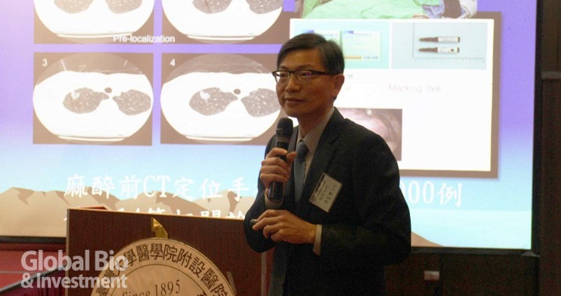 臺大醫院於臺大醫院國際會議中心召開新型肺癌手術的成果發表會,圖為臺大醫院胸腔外科主任陳晉興(攝影/李林璦)