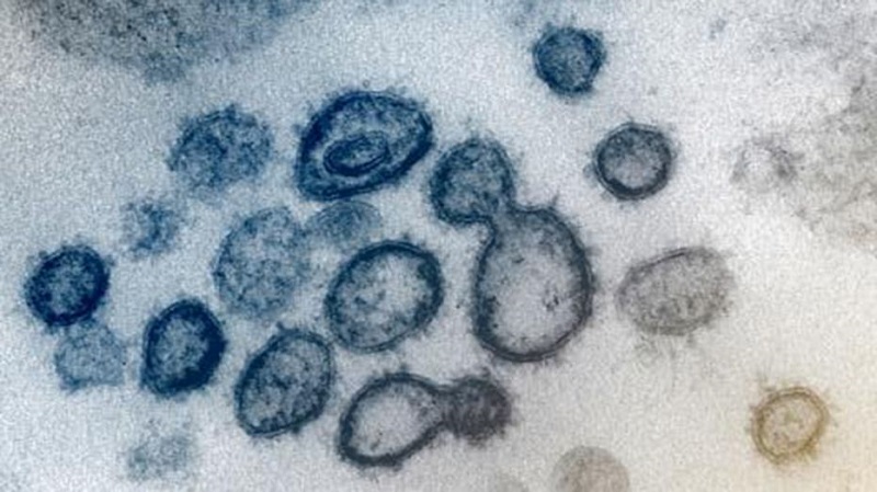 英研究:高親和力新冠病毒奈米抗體 可以與棘狀蛋結合,助力病毒結構研究。(圖片取自網絡)