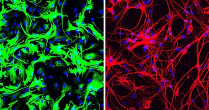 UCSD研究人員使用基因療法將左圖綠色的小鼠星形膠質細胞重編程後,成為右圖紅色的多巴胺神經元。(圖片來源:UC San Diego Health Sciences)